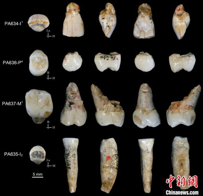 梅铺古人类牙齿。邢松 供图